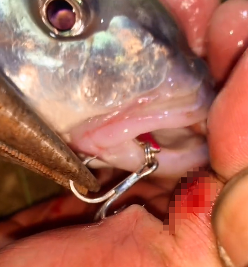 安徽一矛魚人手被鉤扎穿 老虎鉗直接拽掉 網友：三本鉤錨鰱鱅活該