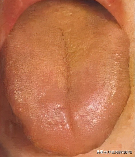 劉主任讓病人伸舌頭，看的是什麼？