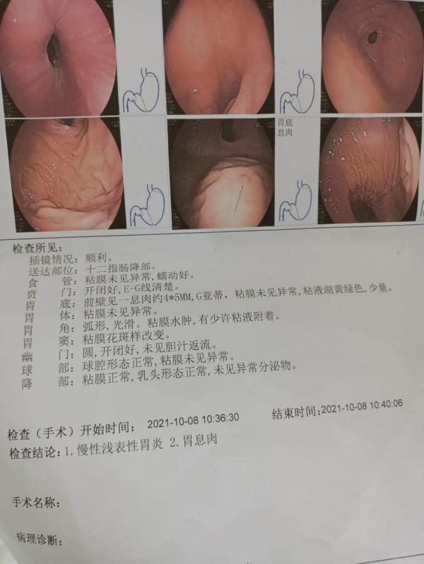 「奇懶觀察」「人生體驗之無痛胃鏡」