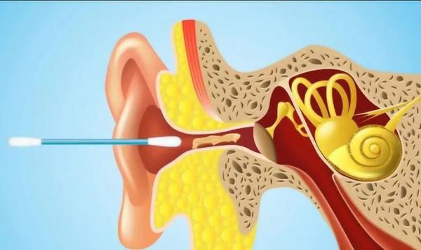 為什麼你會有耳屎、眼屎和鼻屎?它們都是怎麼來的?本文來揭秘 為什麼你會有耳屎、眼屎和鼻屎?它們都是怎麼來的?本文來揭秘