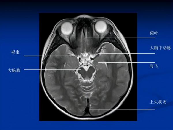 年過50去體檢，不用每個檢查專案都做，但有5個不能少，建議瞭解