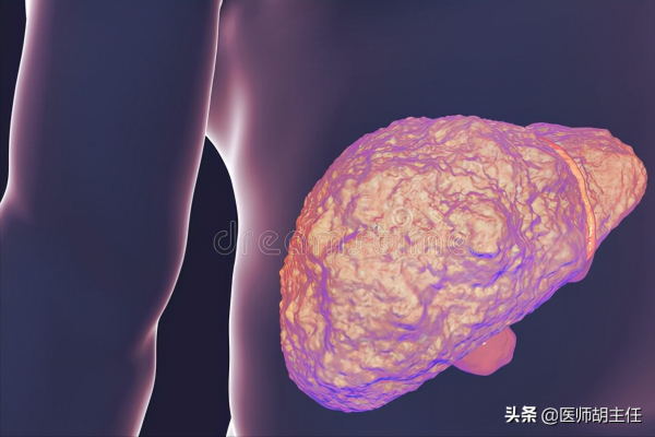 10歲女孩吃出重度肝硬化，醫生提醒：3個壞習慣一定要戒除