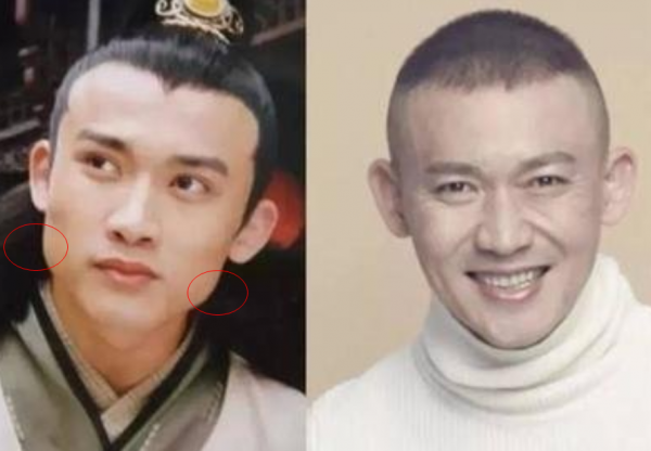 “假臉”大比拼?薛之謙變化大、羅志祥五官前後對比驚人 “假臉”大比拼?薛之謙變化大、羅志祥五官前後對比驚人