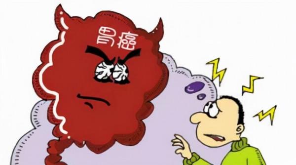 胃癌從早期到晚期，大概要多久？及時發現早期胃癌，牢記3個標誌