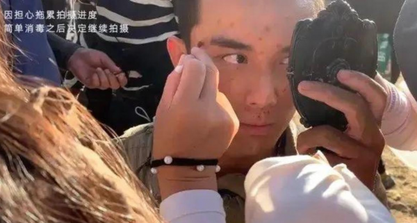 2個月內4位明星因工受傷，張傑摔成腰椎骨裂，羅雲熙被打到出血