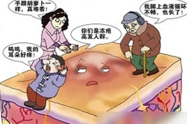 科普三分鐘丨冬天到了小心凍傷