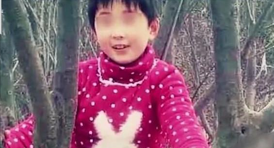 6年前，那個患上罕見怪病的8歲女孩，移植“豬皮”後成功治癒出院