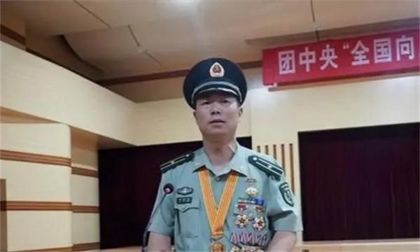 英雄團長祁發寶近況：頭顱模型有明顯缺損，額角傷疤明顯令人痛惜