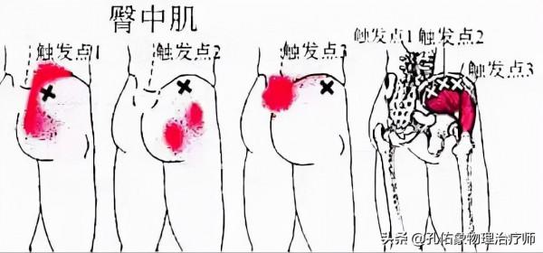 腰腿疼，竟是骨盆惹的禍！還在整天拿著腰椎看嗎？一文告訴您