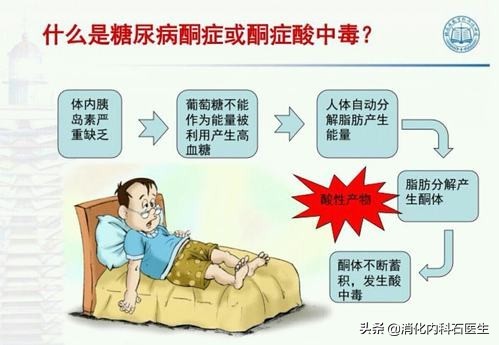 女子腹痛、黃疸，以為結石開腹手術治療，開啟腹腔醫生直嘆氣