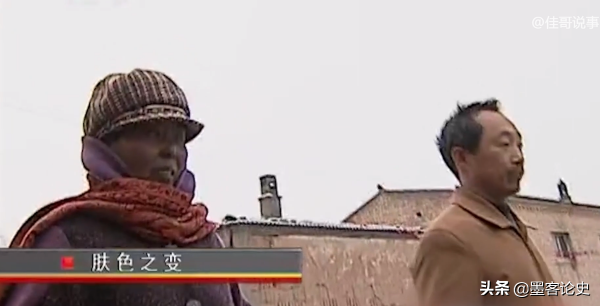 真實故事:山西45歲女子一夜變黑,體重急速增加,手術後讓家人落淚