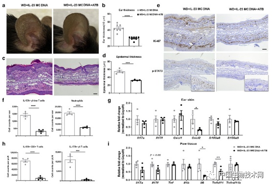 高糖高脂飲食會破壞腸道生態，導致炎症性面板病惡化