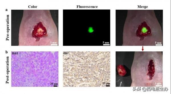 唯一！世界大獎！陝西科學家取得肝癌診療重要成果，國際專家認可