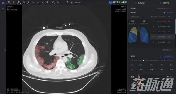剛剛！騰訊拿證，正式生產醫療器械