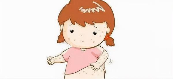 腋窩出現這些問題會引起癢的症狀 主要有四種情況 腋窩出現這些問題會引起癢的症狀 主要有四種情況