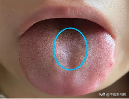 感覺氣不足，一看就會，3分鐘快速分辨哪個臟腑氣虛