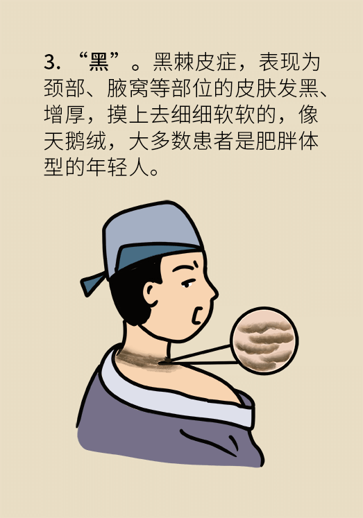 空腹血糖正常等於沒有糖尿病?超過這條警戒線你已被盯上 空腹血糖正常等於沒有糖尿病?超過這條警戒線你已被盯上