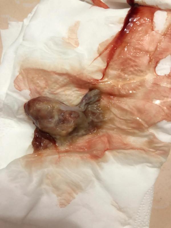 初為人母時血氣方剛，兩年時間，想開了很多