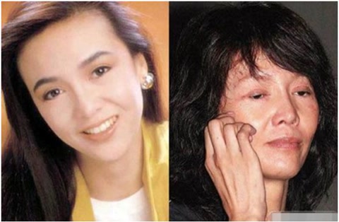 被整容毀了的7位明星，雖各有各的苦衷，卻都美麗盡失、事業滑坡