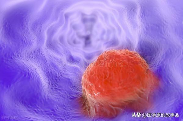 晚期癌症只能活活痛死？癌症根本不用治？腫瘤院長講了十個真相