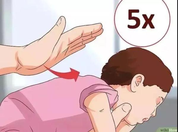 每年近3000孩子因窒息死亡！這些急救法，每個人都要會