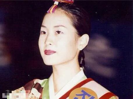 整容後遺症有多可怕?當年爆紅的初代韓流明星,現在臉都認不出 整容後遺症有多可怕?當年爆紅的初代韓流明星,現在臉都認不出