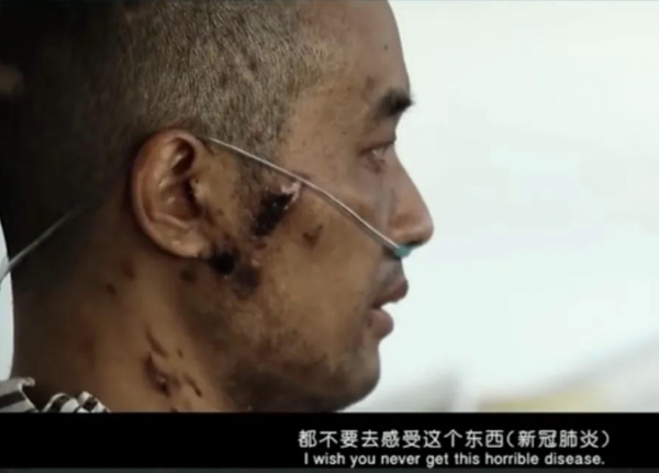 首批新冠倖存者都經歷了什麼？有人經歷4次生死，有人病中報恩