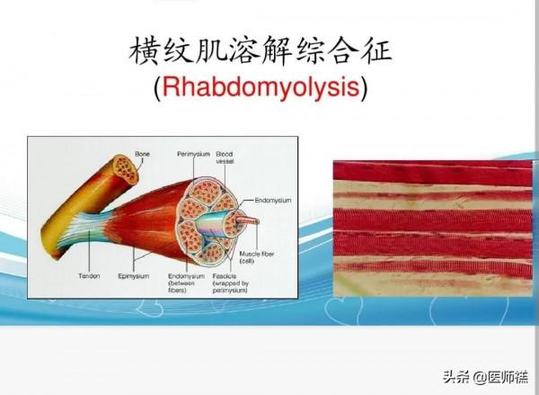 如果您正在服用阿託伐他汀，醫生提示，這些內容值得一讀