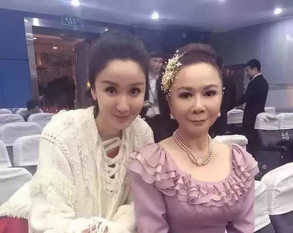 10位“整容上癮”的女星，明知矽膠臉恐怖，為何還是前仆後繼？