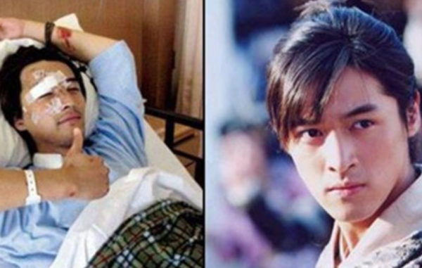 “換頭改命”的6位明星，有的主動承認削骨，有的作品全被下架