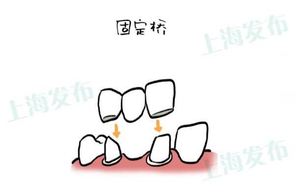【醫聊】怎麼結束牙疼?被傷害的牙神經有話說 【醫聊】怎麼結束牙疼?被傷害的牙神經有話說