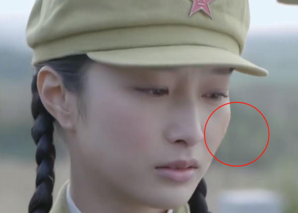 有人熱油澆臉不起泡，有人臉被燙熟創醫療奇蹟，國產劇毀容太離譜