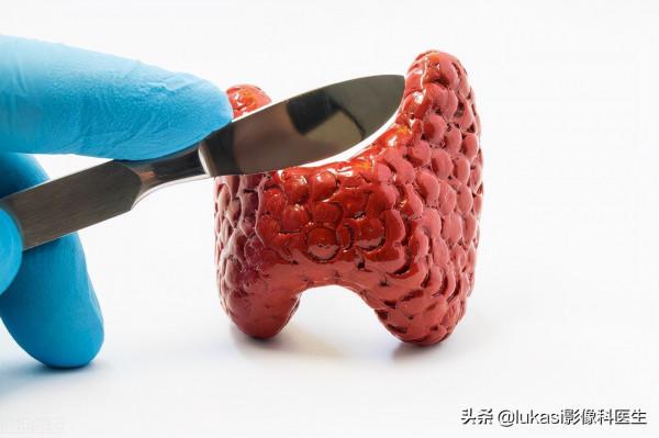 什麼是甲狀腺癌？看看專家是怎麼說的