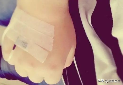 打點滴時空氣進了血管,會死嗎? 打點滴時空氣進了血管,會死嗎?