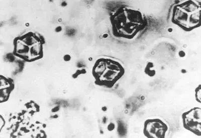 百年瞬間丨我國完成人工全合成結晶牛胰島素