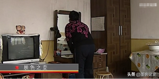 真實故事:山西45歲女子一夜變黑,體重急速增加,手術後讓家人落淚
