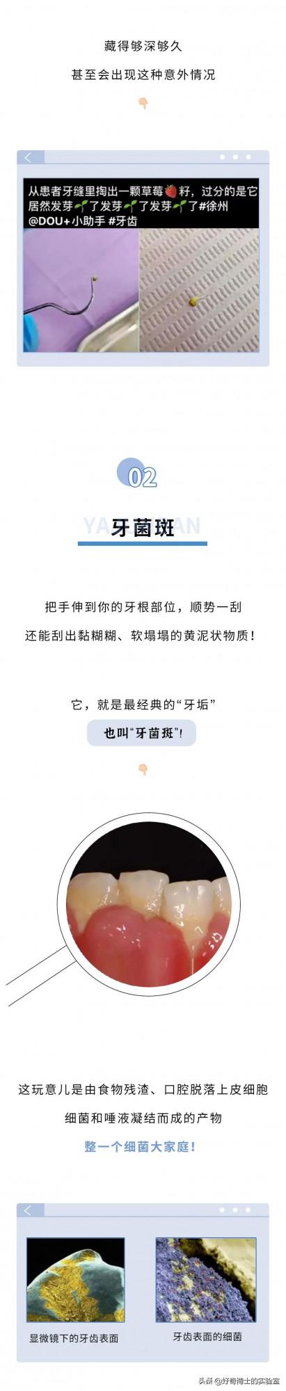 牙縫裡摳出的黃色物質到底是啥?為啥那麼臭 牙縫裡摳出的黃色物質到底是啥?為啥那麼臭