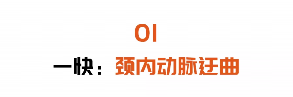 頭暈頭沉、反應力下降？可能是頸動脈出了大問題！2個檢查早發現
