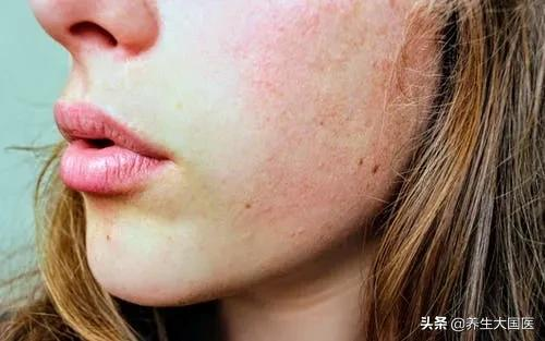 嘴唇起皮、口渴難耐?可能不是秋燥,提高警惕,儘早治療 嘴唇起皮、口渴難耐?可能不是秋燥,提高警惕,儘早治療