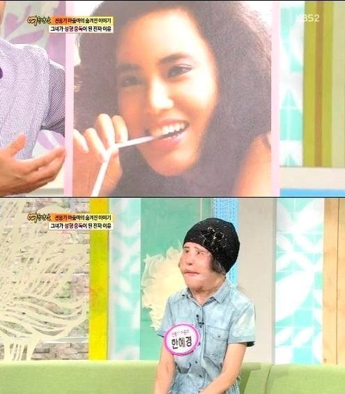 韓國“電風扇大媽”：為變美整容，給自己注射大豆油，用石蠟填充