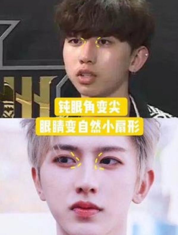 “假臉”大比拼?薛之謙變化大、羅志祥五官前後對比驚人 “假臉”大比拼?薛之謙變化大、羅志祥五官前後對比驚人