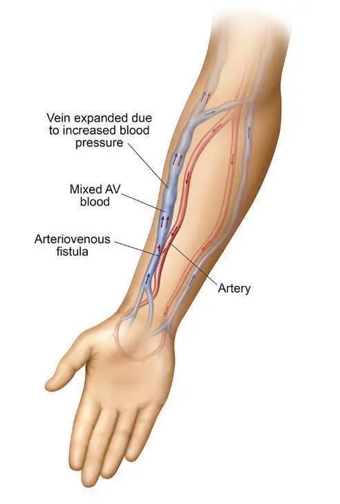 又發現人類在進化的證據了？