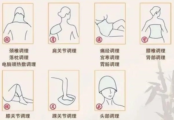 “包”治百痛!肩頸痛、腰腿痛……冬天的痛“包”懂 “包”治百痛!肩頸痛、腰腿痛……冬天的痛“包”懂