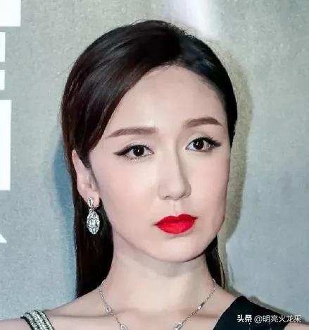 娛樂圈明星整容前後大對比，打消你整容的心