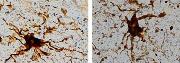 科學家發現混亂的“殭屍”細胞,人走後它還能存活嗎? 科學家發現混亂的“殭屍”細胞,人走後它還能存活嗎?
