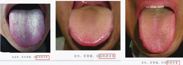 九種常見體質,你是哪一種? 九種常見體質,你是哪一種?