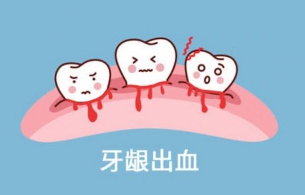 刷牙出血、咬蘋果也出血，多是脾不統血，僅用三味藥，補脾益氣