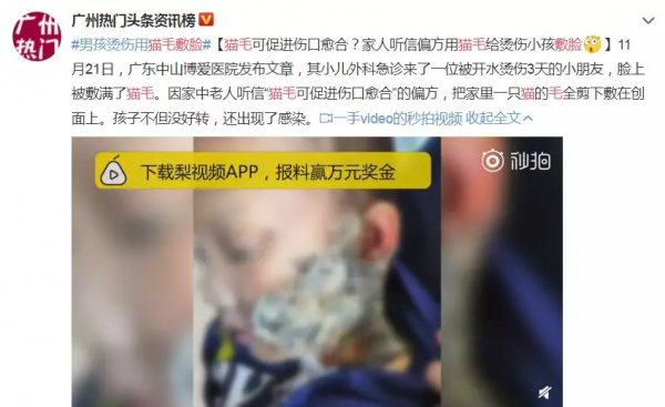 屍油敷臉、農藥洗澡、喂活蝌蚪，中國的家長們正在用偏方“謀殺”孩子