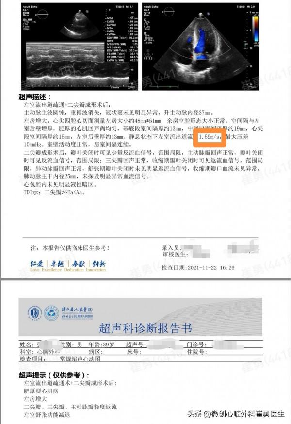 無可見疤痕的微創肥厚梗阻性心肌病手術 無可見疤痕的微創肥厚梗阻性心肌病手術