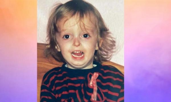 全世界僅有10人，英國小夥不幸患上MDP綜合症